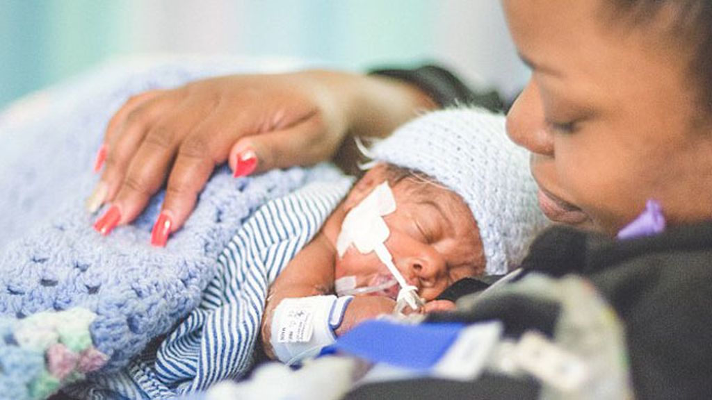 Caricias que curan a bebés enfermos