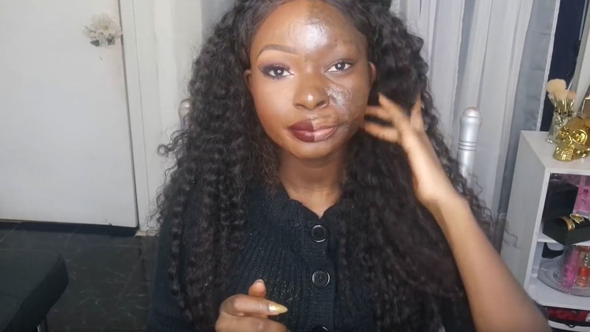 Triunfa en la red con tutoriales de maquillaje tras sobrevivir a sus graves quemaduras