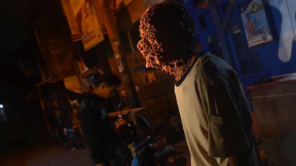 Devastado por tumores benignos