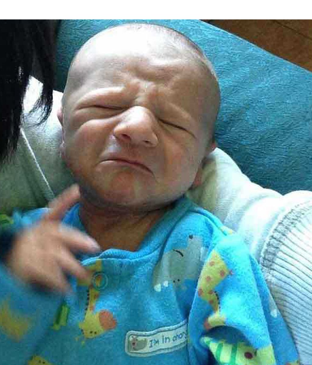 Recién nacidos con líneas de expresión