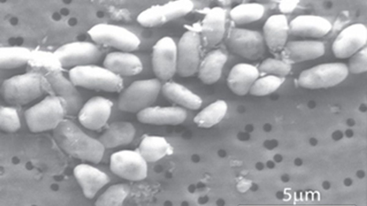 La NASA encuentra una bacteria capaz de vivir y crecer en arsénico