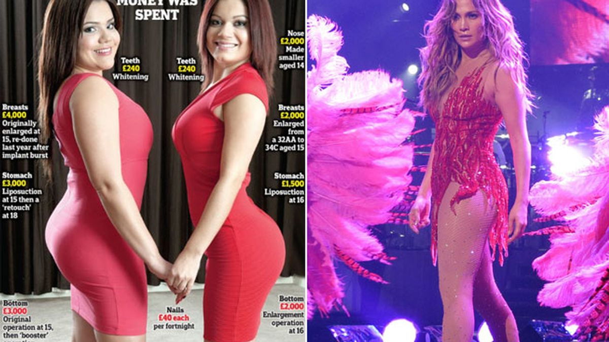 Una madre gasta más de 23.000 euros en que sus hijas se parezcan a Jennifer Lopez