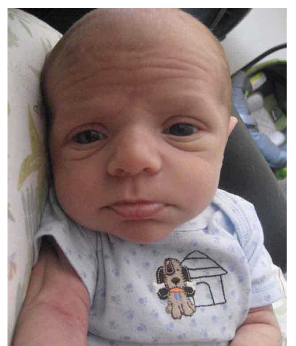 Recién nacidos con líneas de expresión