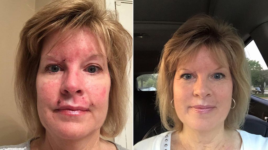 La lucha contra el cáncer de piel en imágenes