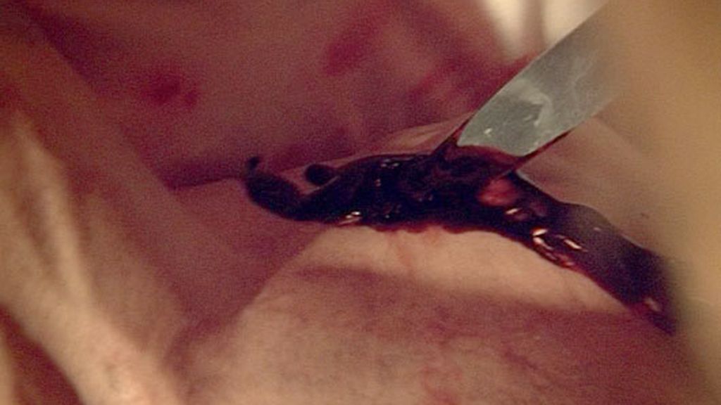 Duque, herido de bala