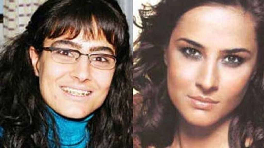 El antes y el después