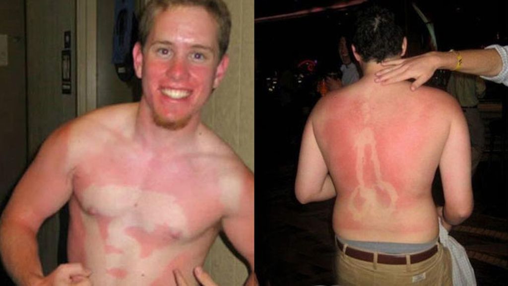 Cuando el sol te marca