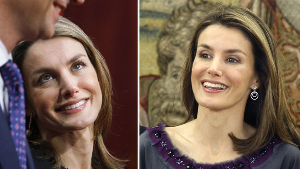 ¿Sonrisa distinta debido a retoques estéticos?