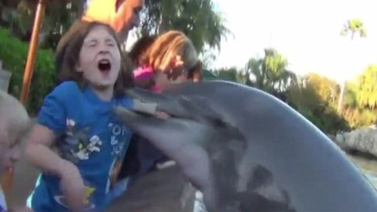 Un delfín muerde a una niña en Florida