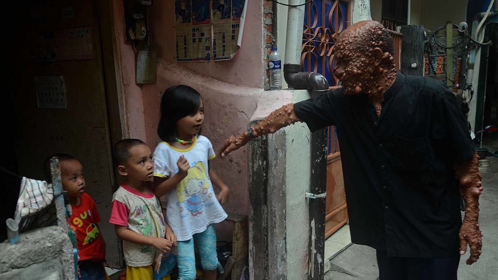 Devastado por tumores benignos