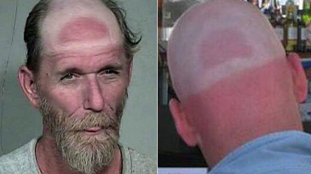 Cuando el sol te marca