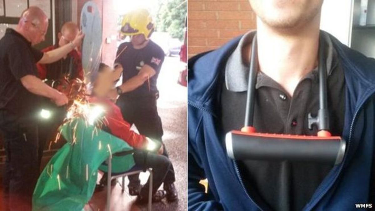 Los bomberos de Coventry (Reino Unido) liberan a un joven de un cepo de alta seguridad cerrado alrededor de su cuello
