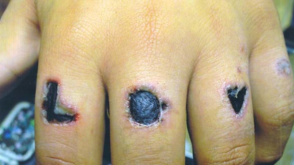 Cuando te tatúa un ‘chapucero’