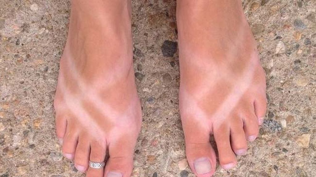 Cuando el sol te marca