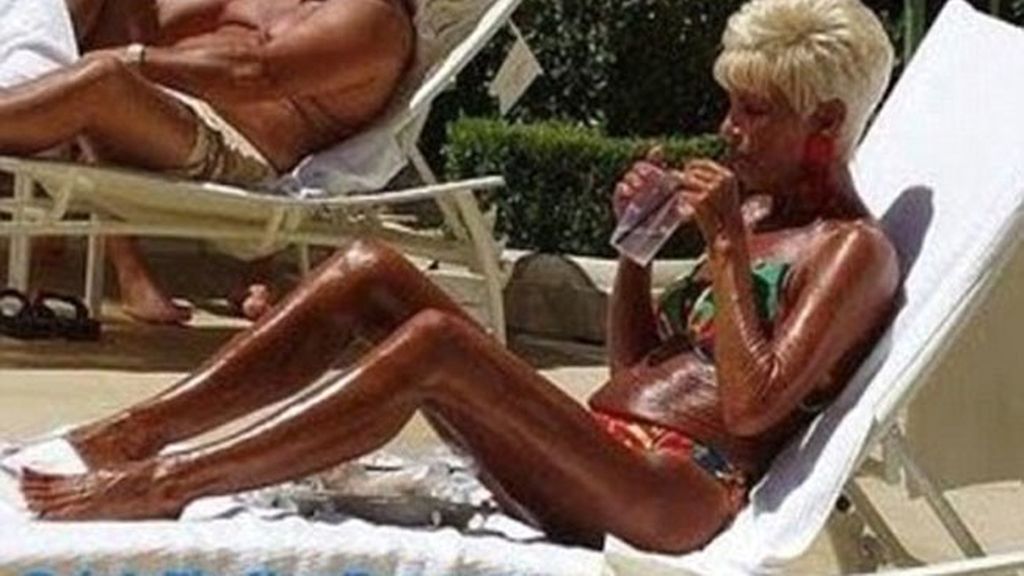 El bronceado, entre la belleza y el horror