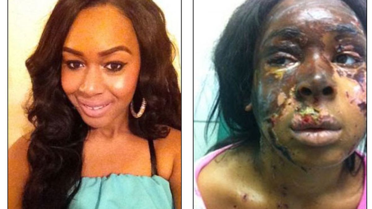 Naomi Oni, antes y después de ser atacada con ácido en plena calle. Foto: Dailymail
