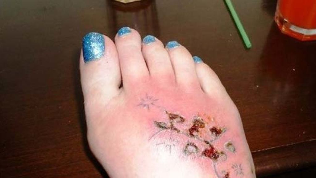 Cuando te tatúa un ‘chapucero’