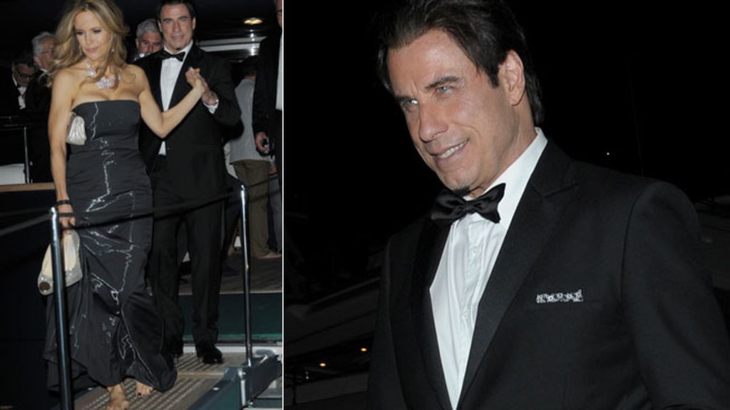 La espalda de Shayk, el tupé de Bieber, la pierna 'pin-up' de Minogue...