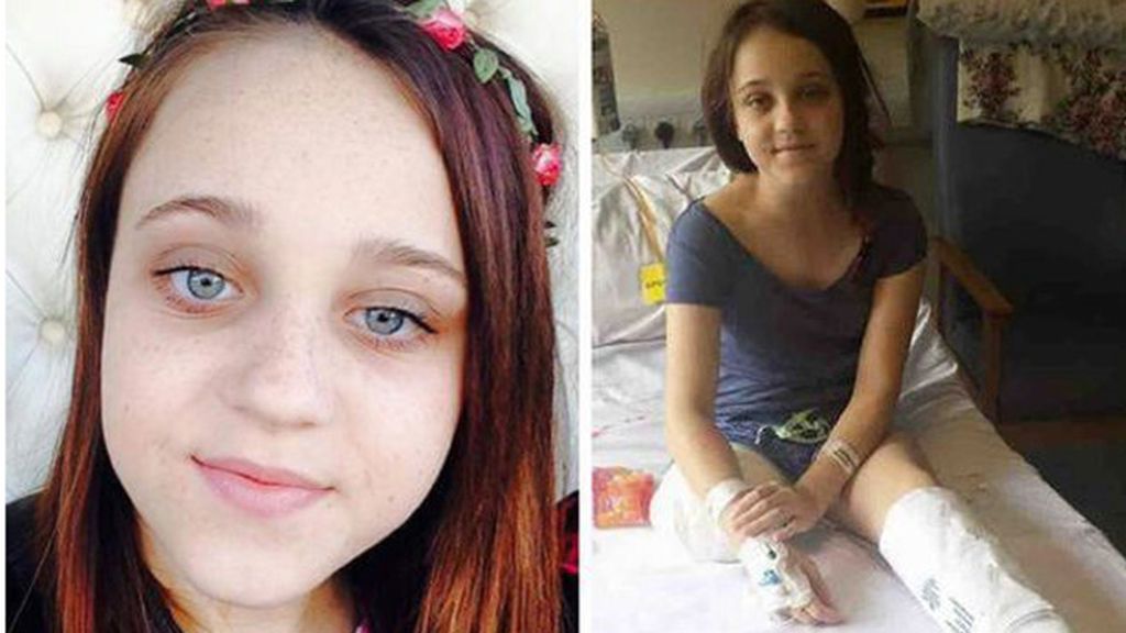 Una niña logra que los médicos le amputen la pierna Una niña logra que los médicos le amputen la pierna