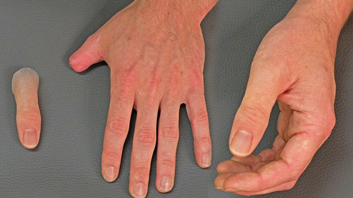 Las prótesis hiperreales de dedos creadas por una empresa alemana