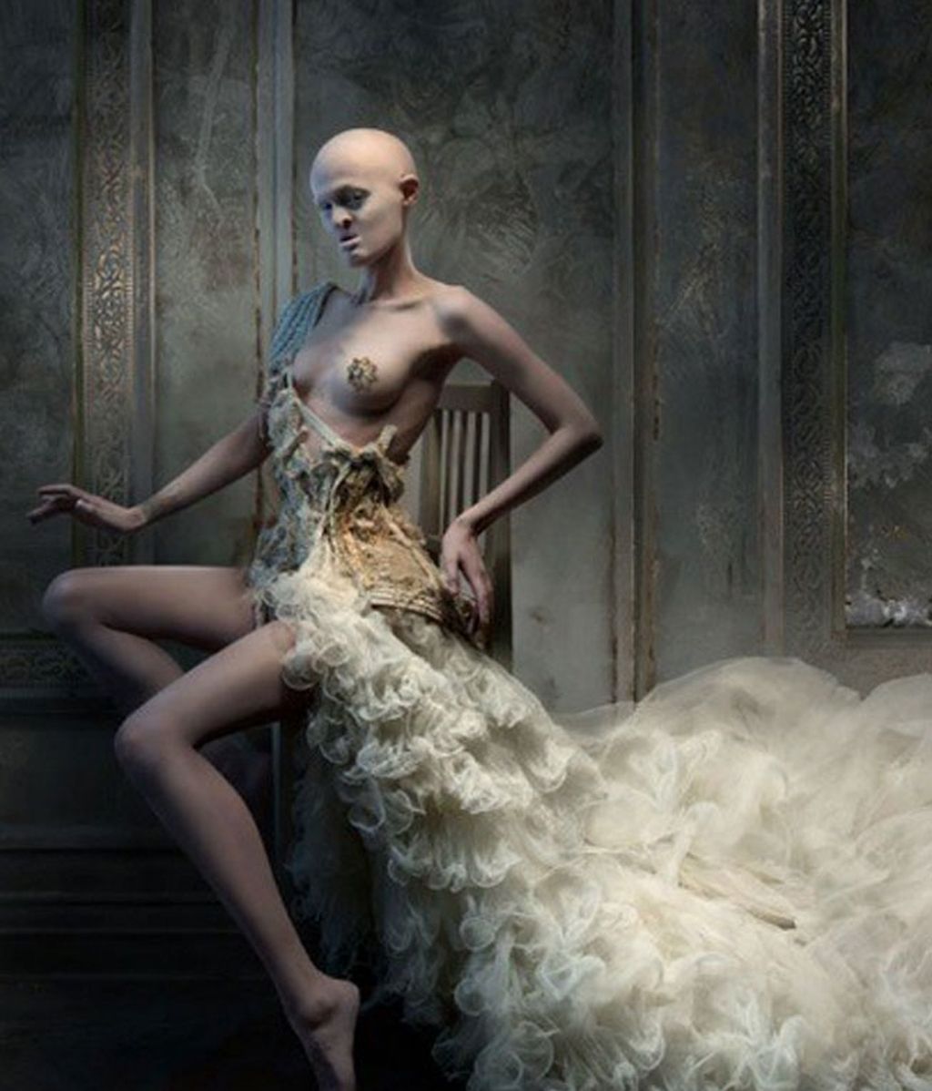 Melanie Gaydos, del complejo por su Displasia Ectodérmica a la pasarela