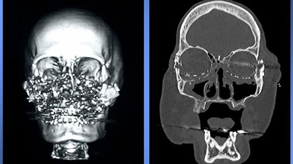 El nuevo rostro de Connie Culp