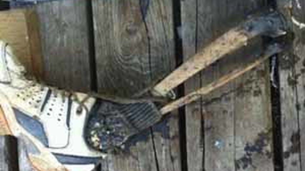 Imagen de uno de los pies encontrados