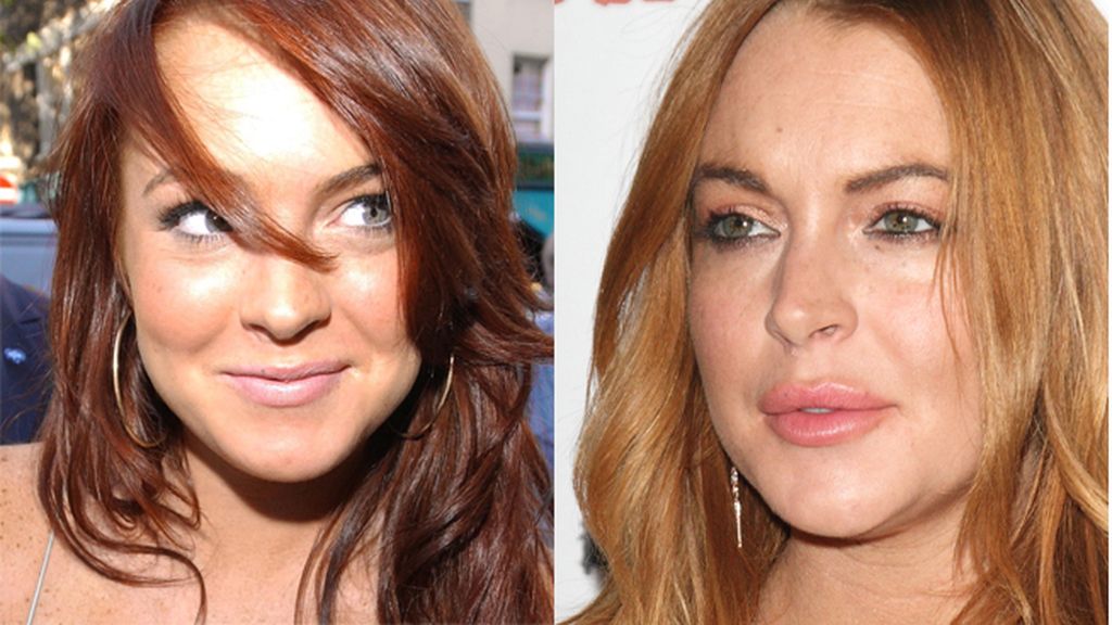 Lindsay Lohan (28) ha sido de las pocas en admitir que es adicta a los retoques