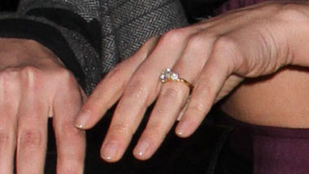 anillo