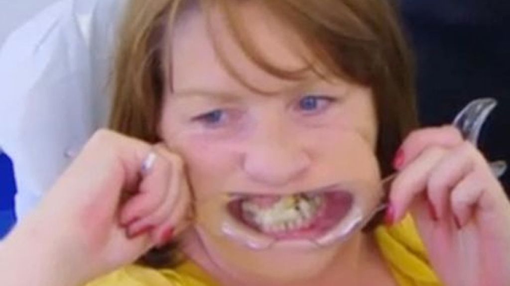 Se pega los dientes con pegamento por miedo al dentista