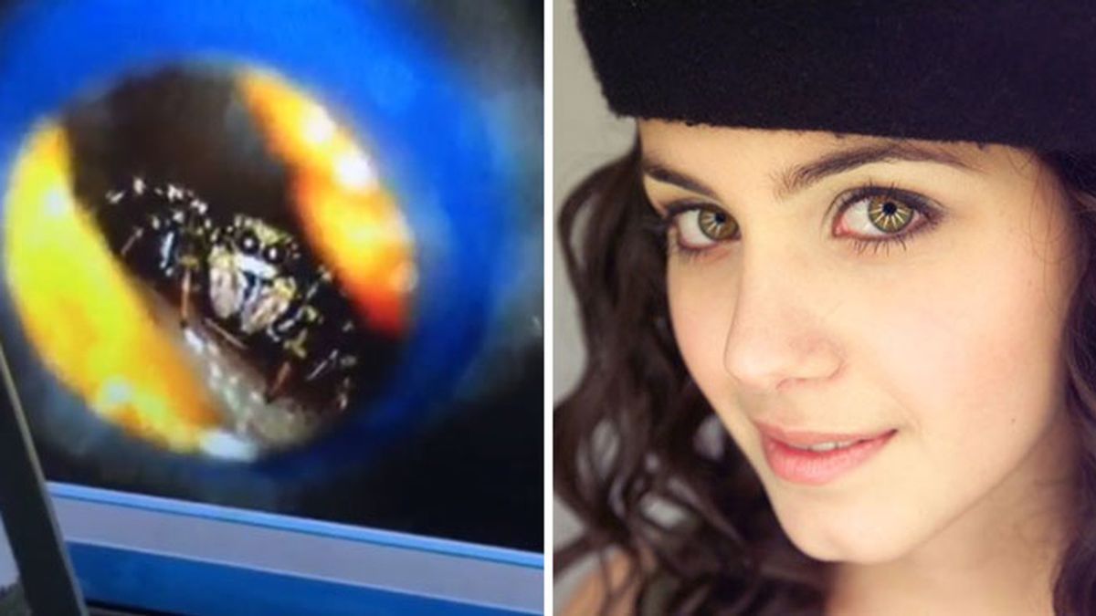 La cantante británica Katie Melua vivió con una araña en el oído durante una semana
