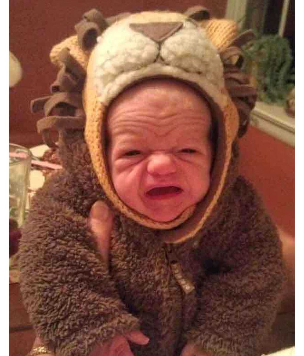 Recién nacidos con líneas de expresión