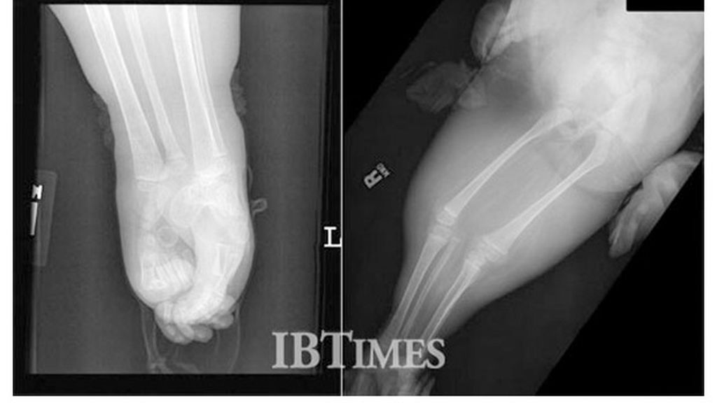 Las piernas de Shiloh Pepin