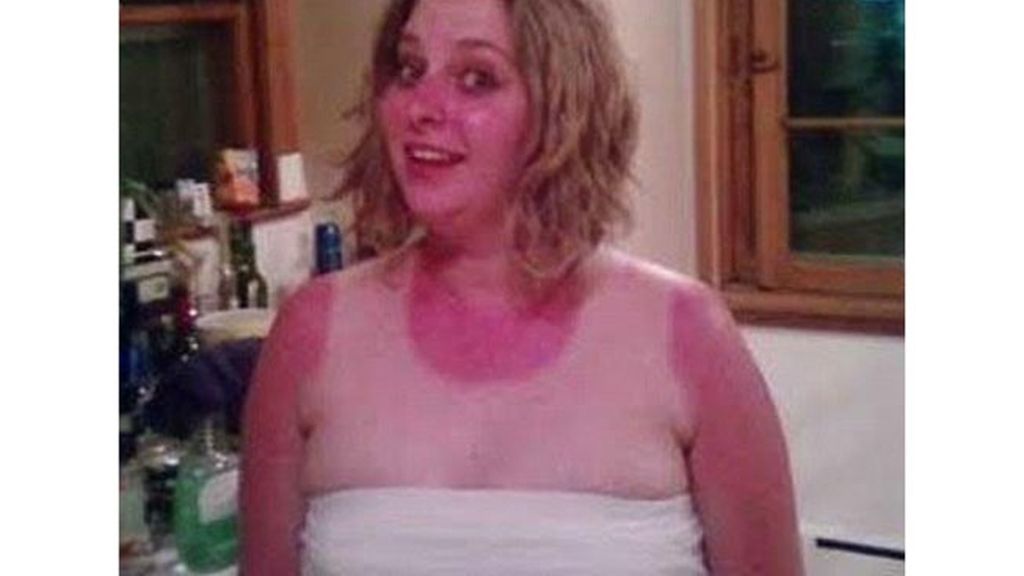 El bronceado, entre la belleza y el horror