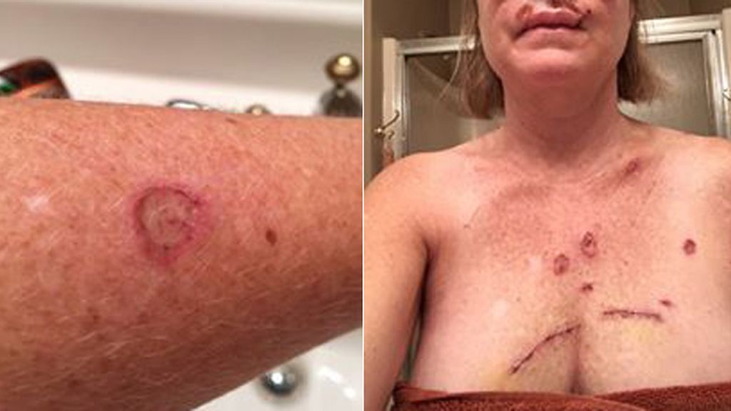 La lucha contra el cáncer de piel en imágenes