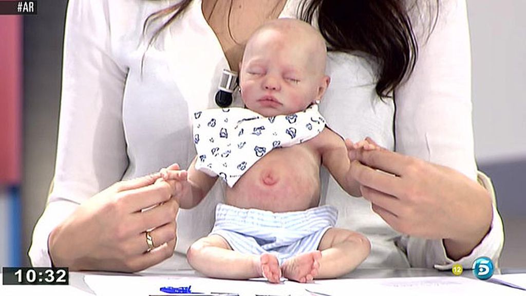 Joaquín Prat: "Me da bastante repelús"