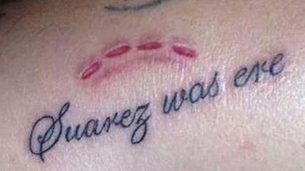 Se tatúa la mordida de Suarez y se lo hacen mal