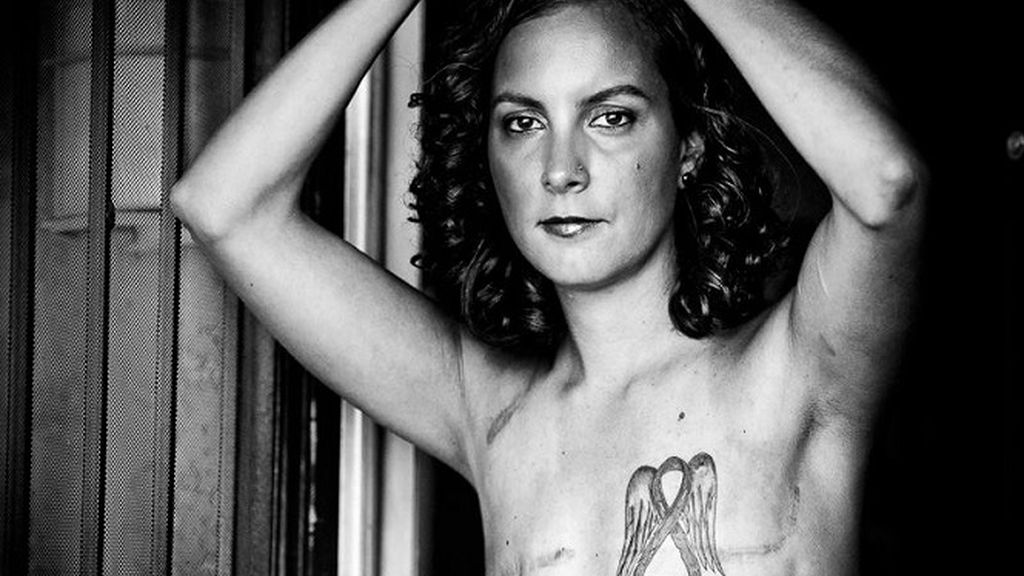 La fotos de supervivientes de cáncer de mama que Facebook no quiere mostrar