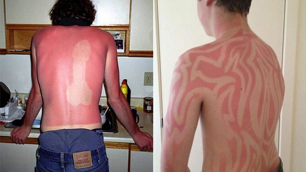 Cuando el sol te marca