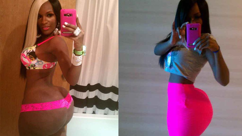 Adicta a las inyecciones de silicona