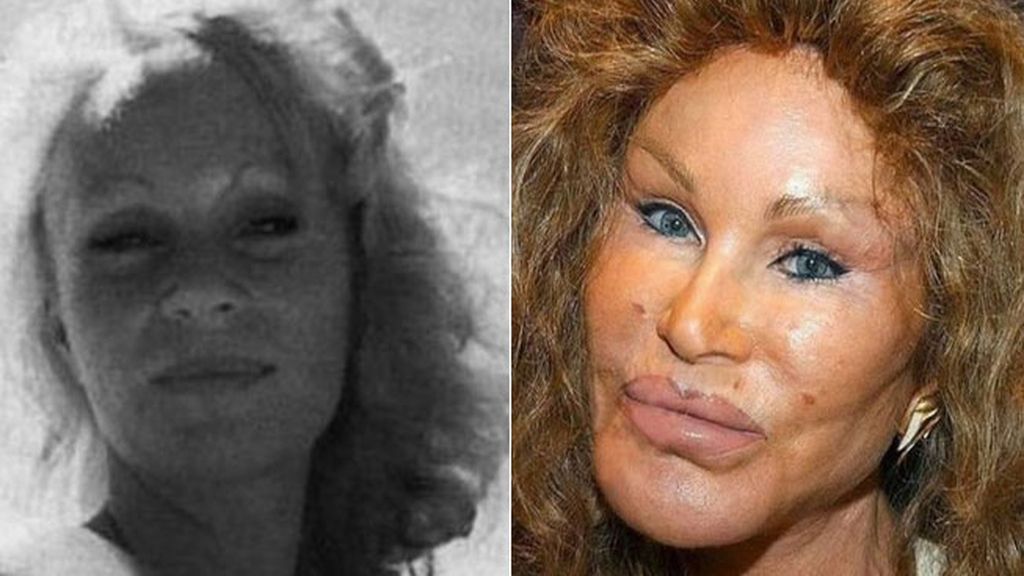 Jocelyn Wildenstein