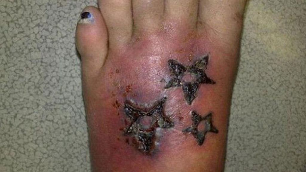 Cuando te tatúa un ‘chapucero’