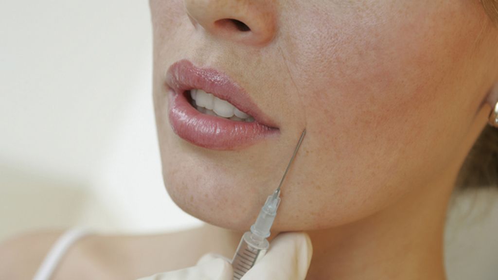 Tratamiento Botox