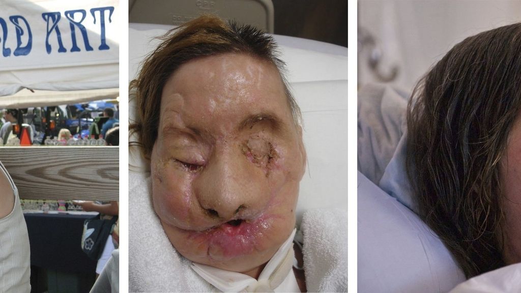 Carla fue atacada por un chimpancé que le desfiguró el rostro.