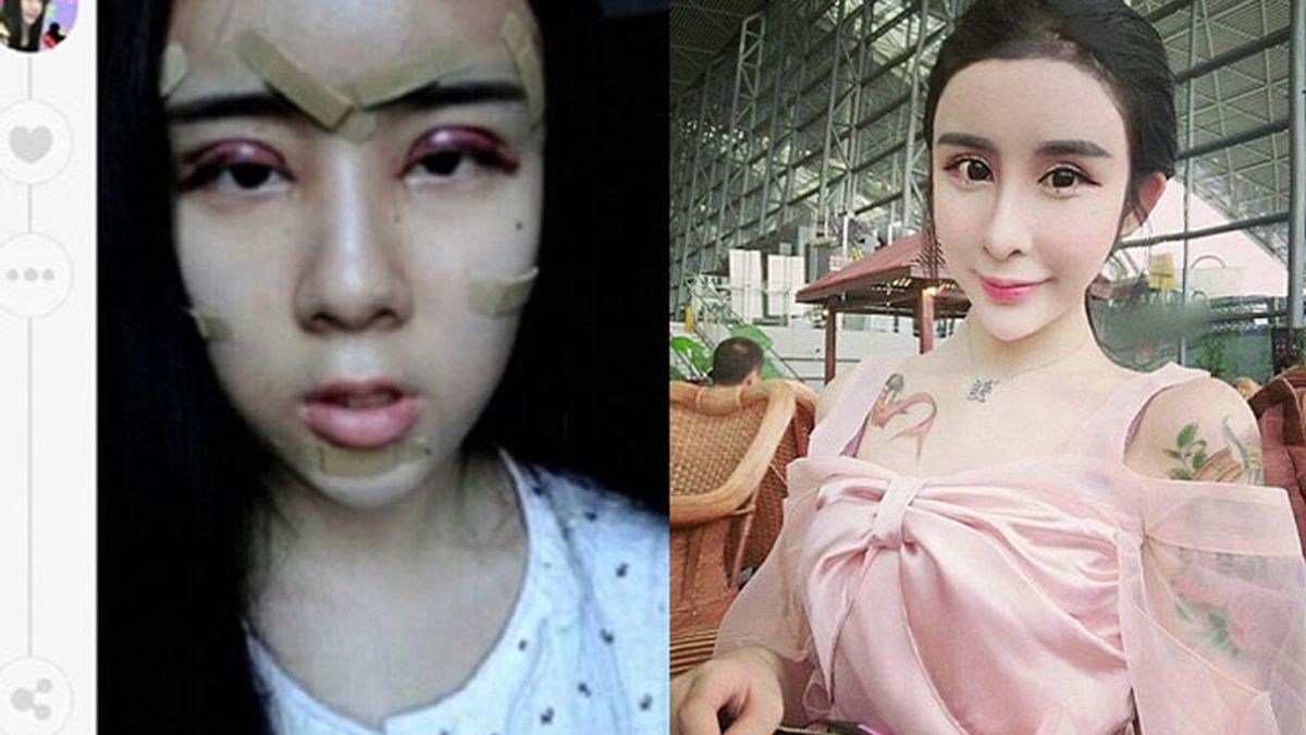 Lee Hee Danae, adolescente china, cirugía estética