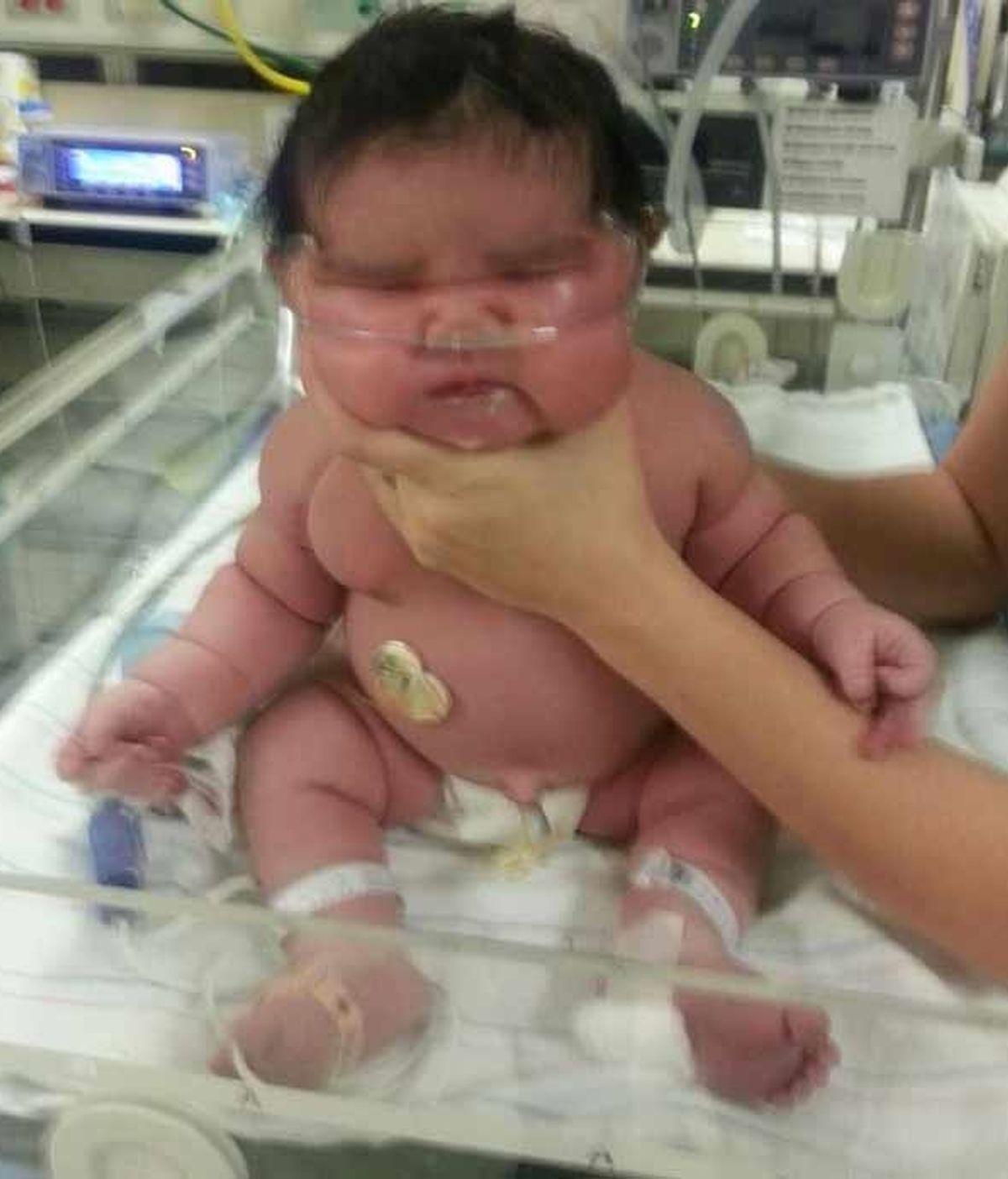 Nace una bebé de 6,2 kilos en un hospital de Estados Unidos