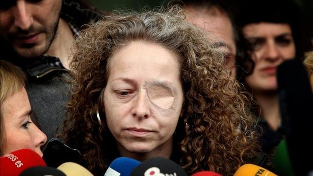 Ester Quintana, perdió un ojo durante la huelga general del 2012