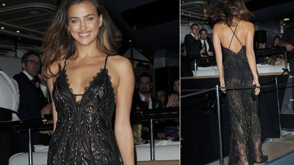 La espalda de Shayk, el tupé de Bieber, la pierna 'pin-up' de Minogue...