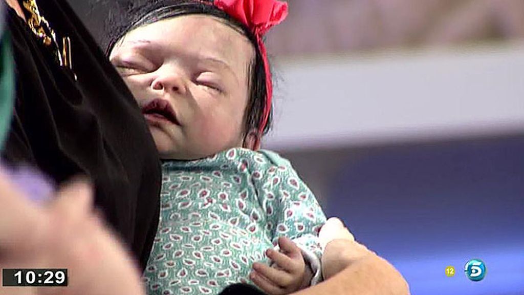 Joaquín Prat: "Me da bastante repelús"