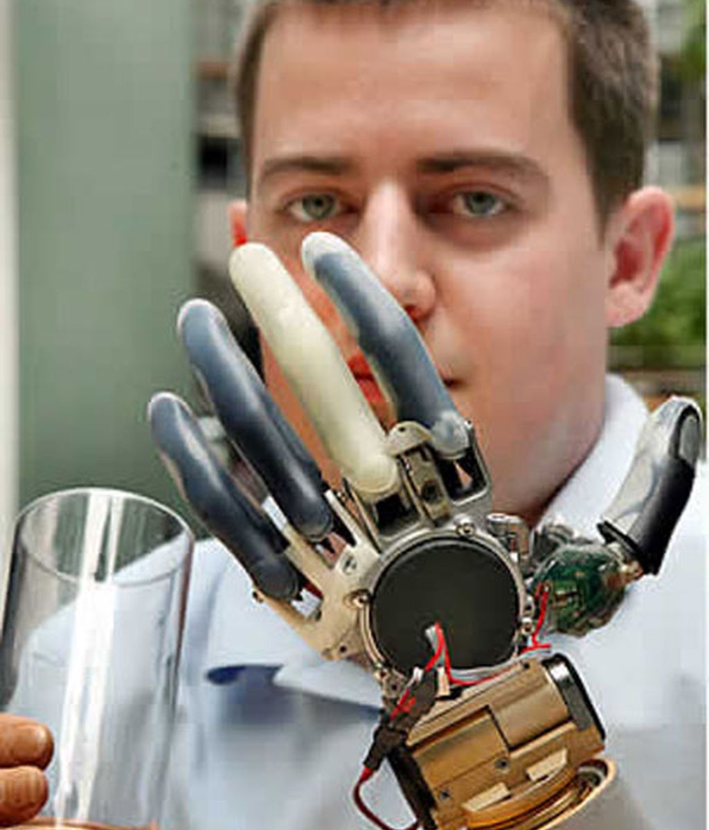 Un brazo artificial de récord